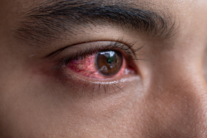 5 Eye Diseases That Can Be Prevented with Timely Checkups